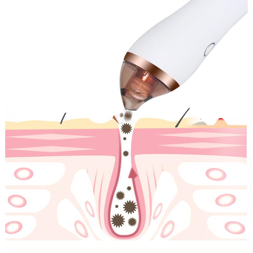 4-in-1 Body Gua Sha Cupping & Blackhead Remover Machine – Facial Pore Deep Cleansing