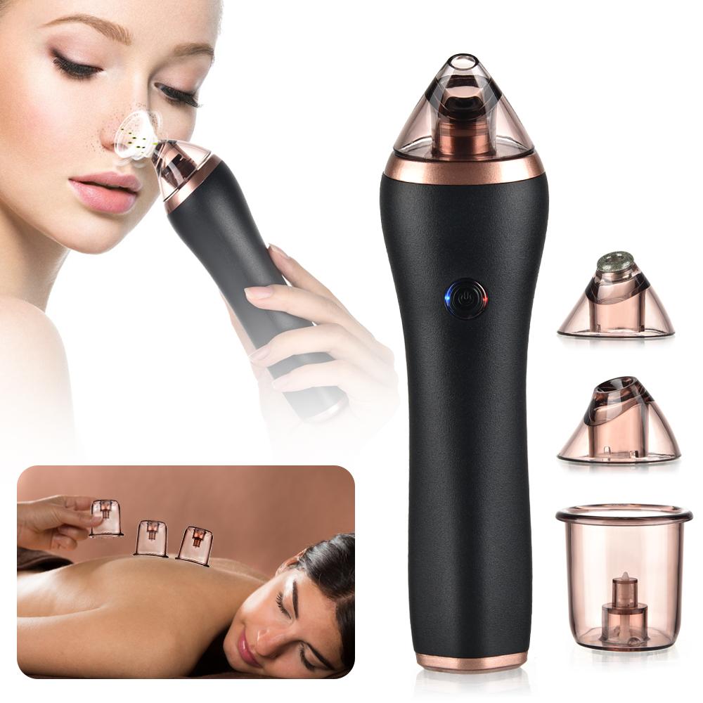 4-in-1 Body Gua Sha Cupping & Blackhead Remover Machine – Facial Pore Deep Cleansing