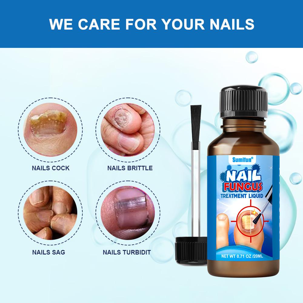 Sumifun - Nail Fungus Treatment Liquid (Original)